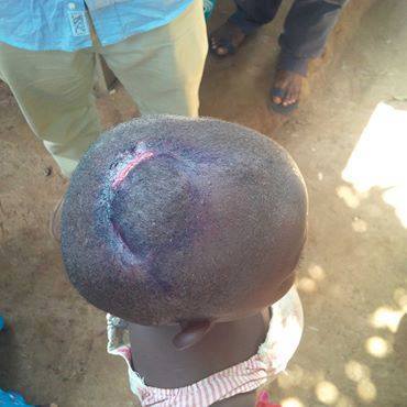 One the victims of the attack. A child with cuts to the head.