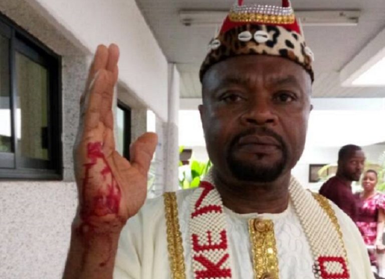 Anambra Traditional Ruler Escapes Assassination Attempt At IGP’s Office