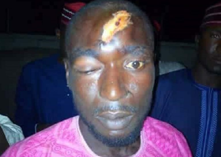 Bloodly Eid-El-Kabir: Kwankwasiyya Followers Clash In Kano, 23 Injured
