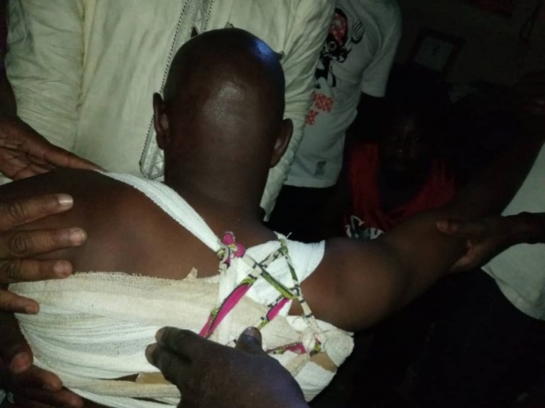 Hired Killers Trail Al-Makura’s Media Aide, Injure Him