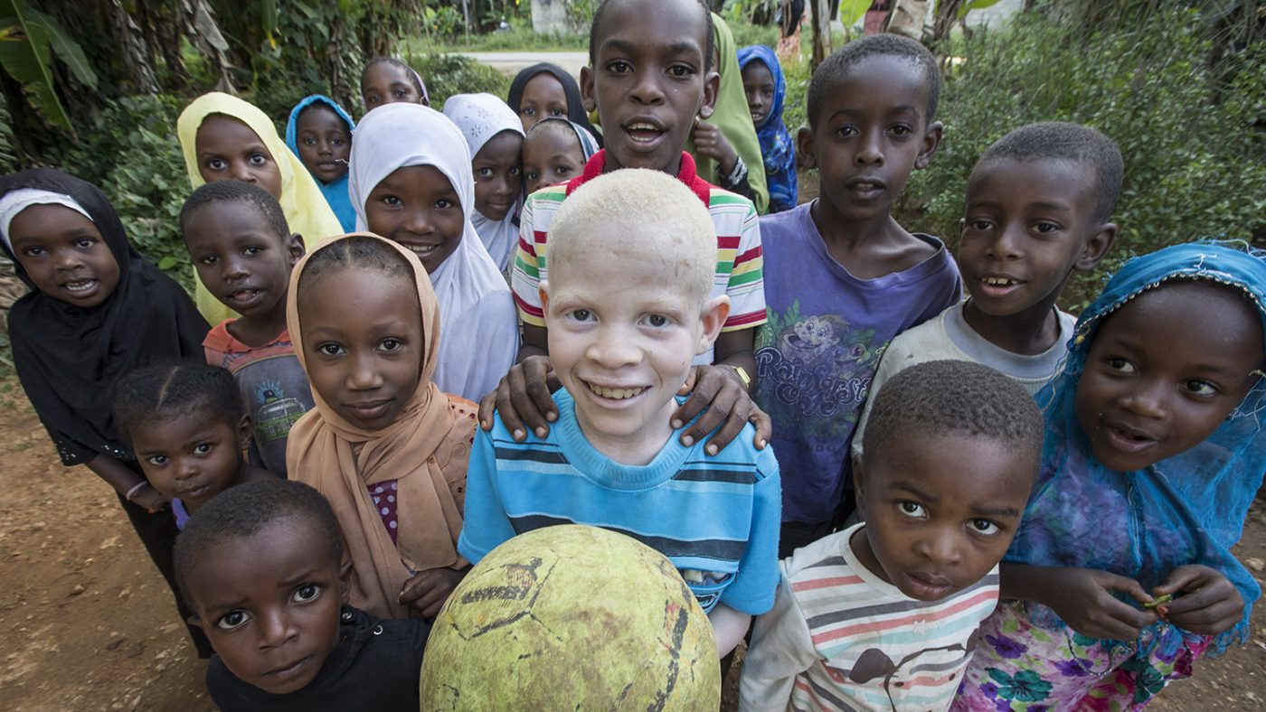 A Call For Strict Measures - An Appeal To African Nation-States: An Albino ...