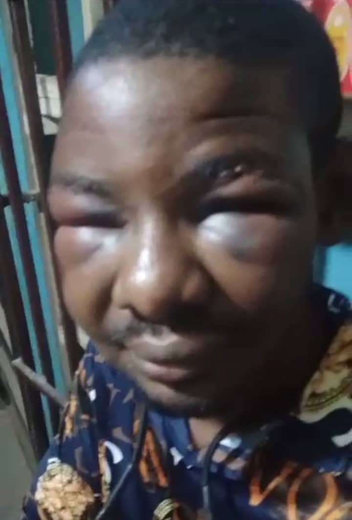 Anambra Man Battered, Robbed, After ‘Okada Man’ Diverted Him to Kidnappers’ Den