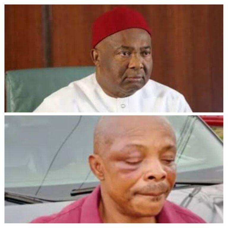 I Will Not Do That Again, ‘It Is Regrettable’ – Uzodimma Apologises Over Attack On NLC President