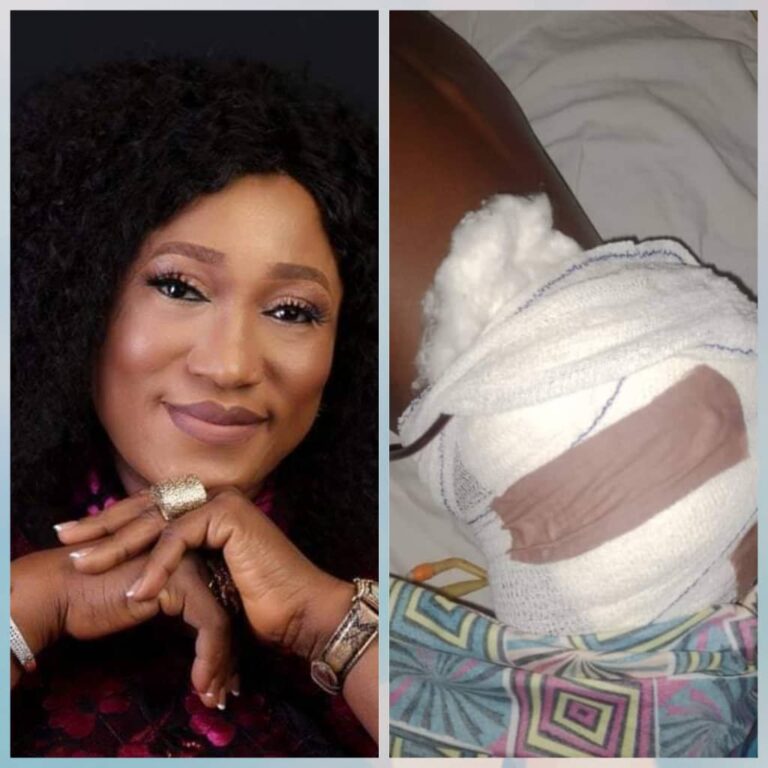 In Anambra, Nanka Family Lauds Federal Lawmaker, Hon. Nnabuife’s Intervention in Son’s Ailment, Pledges Solidarity Ahead of Rerun Election