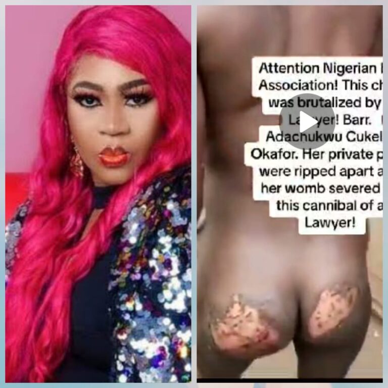 Soludo, Police React As Anambra Lawyer Inserts Hot Knife into Her Housekeeper’s Private Part, Flees (Video)