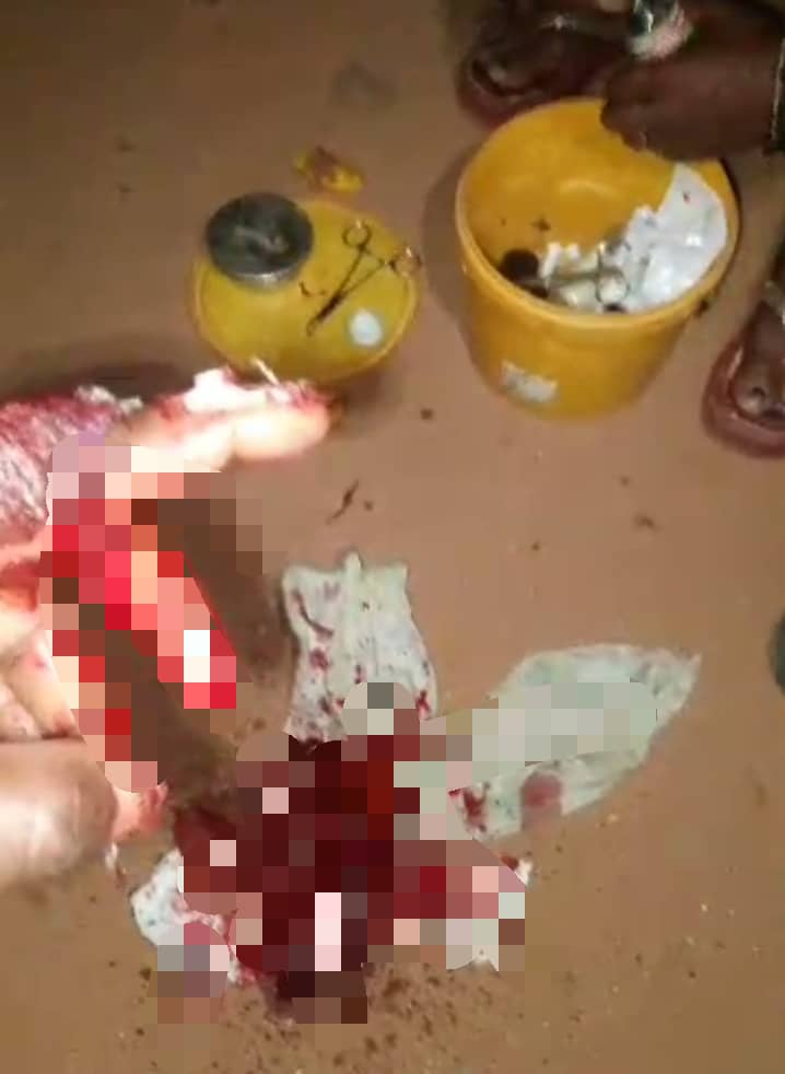 Herdsmen Strike Again, Cut Off Man’s Finger in Anambra (Video)