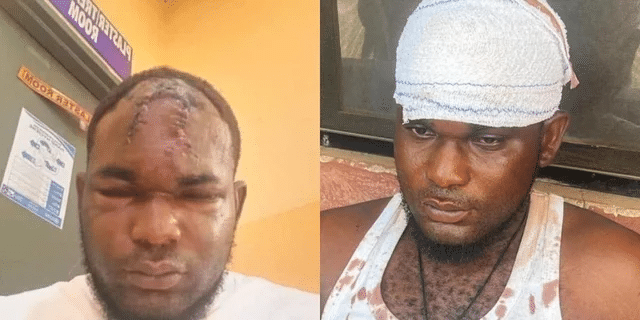 Police Officers Beat 28-Yr-Old Man to Death, Extort N150k from Him, Claim He Hit His Head on the Wall