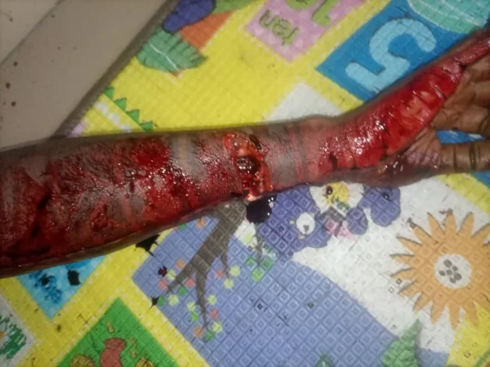 Police nab 23-year-old for alleged machete killing of girlfriend