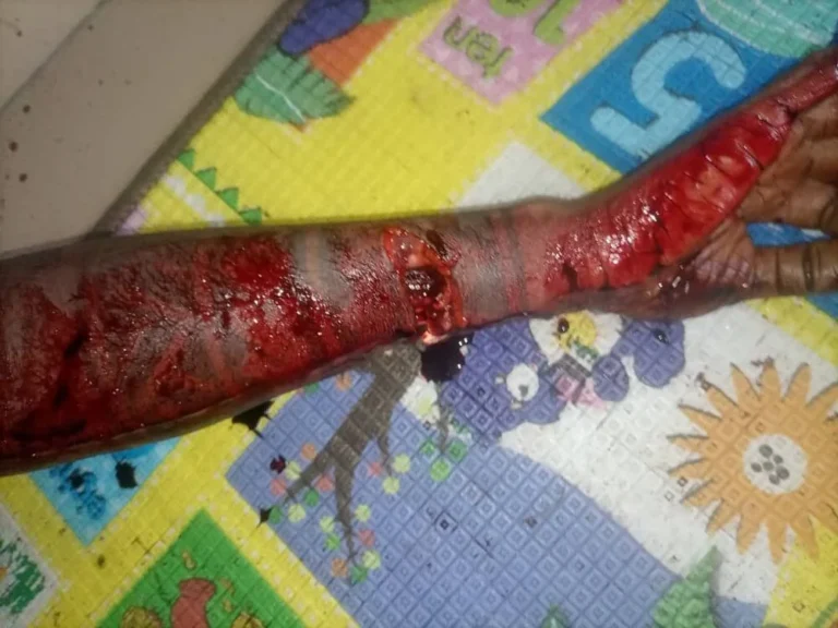 Police nab 23-year-old for alleged machete killing of girlfriend