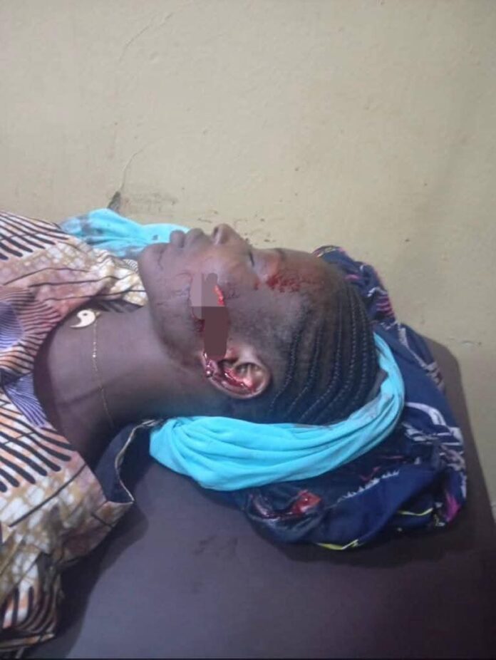 Suspected phone snatcher attack woman, cut off 2 fingers, ear