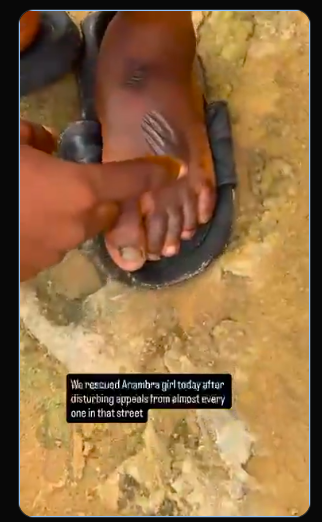 Five Years of Slavery: NAPTIP Rescues 12-Year-Old Domestic Worker Tortured and Denied Education in Lagos