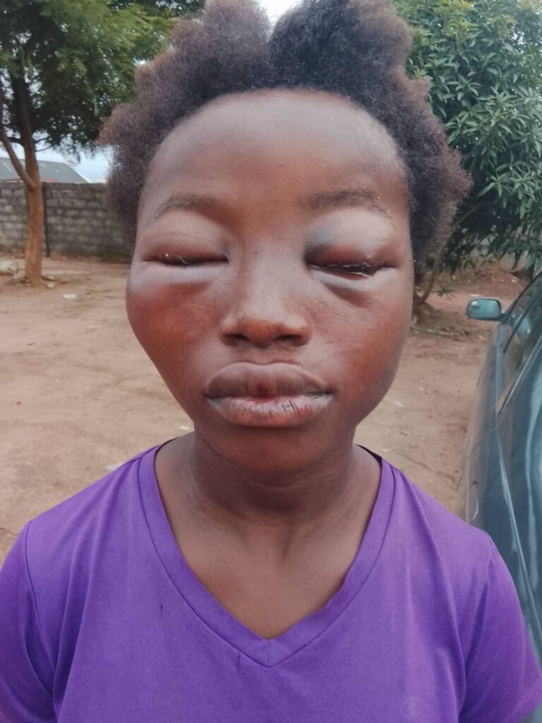 Child Abuse Scandal: Outrage in Owerri Over Brutal Assault on Domestic Worker